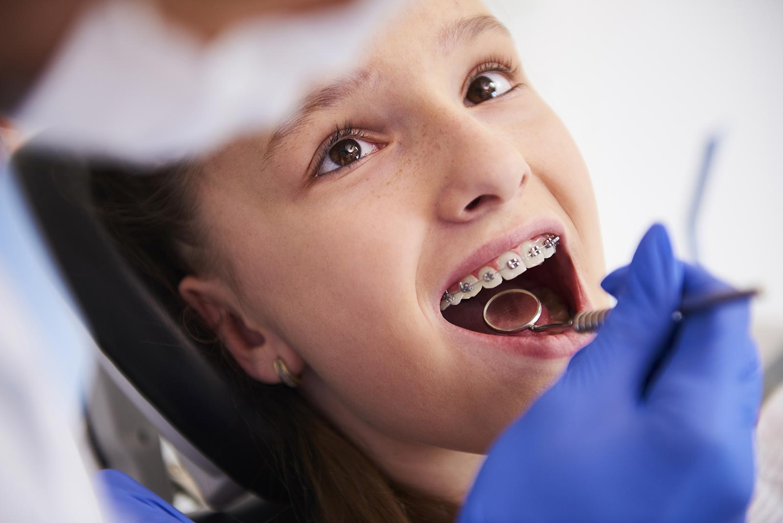 ODONTOPEDIATRIA2 Simetría dental