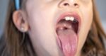 lengua blanca