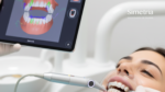dental monitoring